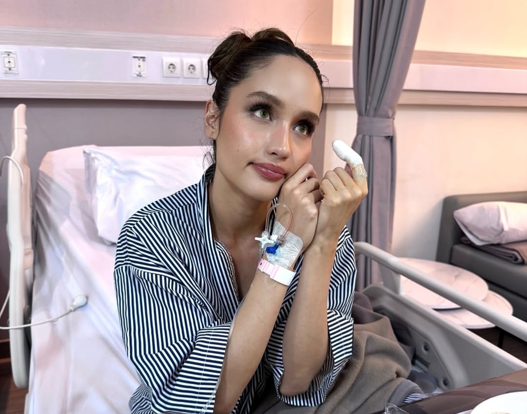 Bukan Sekadar Luka Biasa, Cinta Laura Ungkap Alasan Harus Operasi Usai Tersabet Pisau Daging