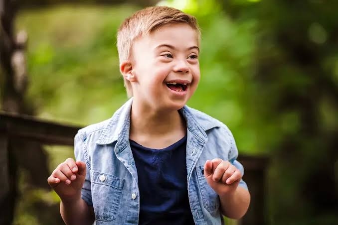 Kegiatan yang Cocok untuk Anak Pengidap Down Syndrome
