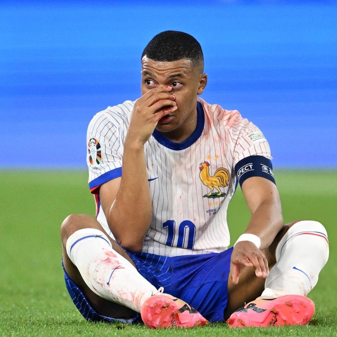 Waduh! Hidung Kylian Mbappe Patah Akibat Bertubrukan dengan Bek Austria, Terancam Absen di Sisa Piala Eropa 2024?