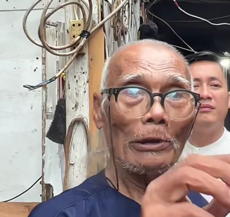 Kondisi Terkini Diding Boneng: Sesak Napas Hebat, Kini Berangsur Pulih 