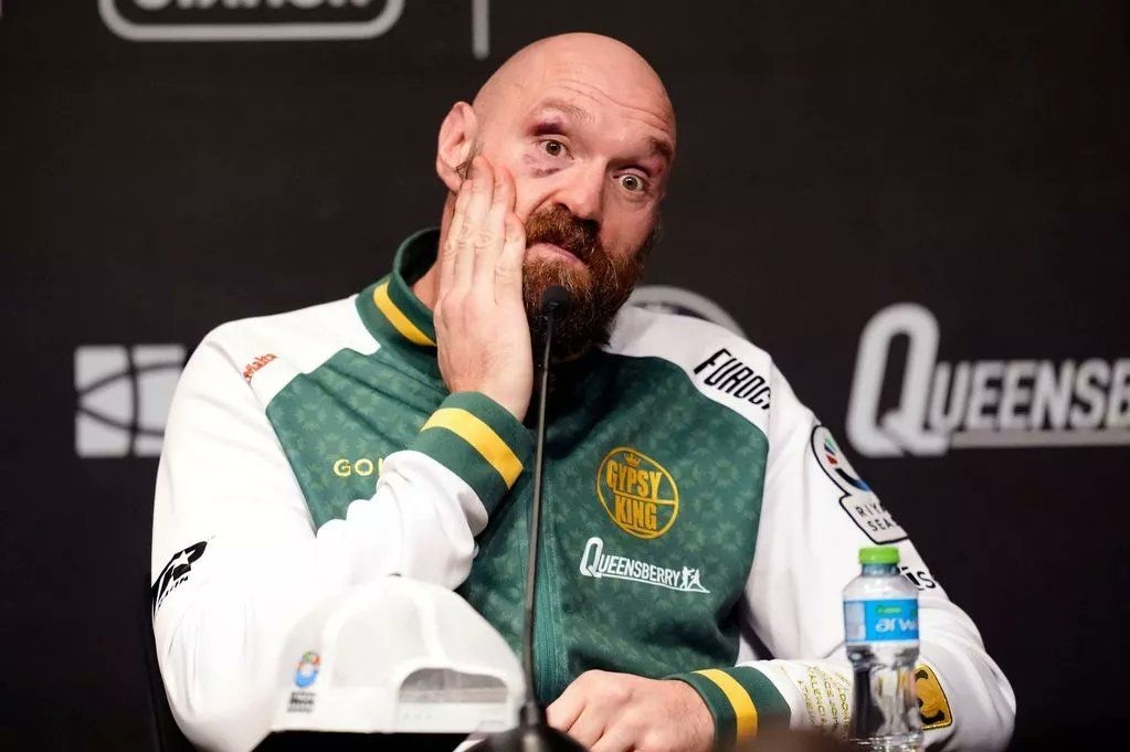 Bobot Turun Drastis! Tyson Fury Klaim Sudah Capai Berat Ideal Jelang Duel Lawan Arslanbek Makhmudov