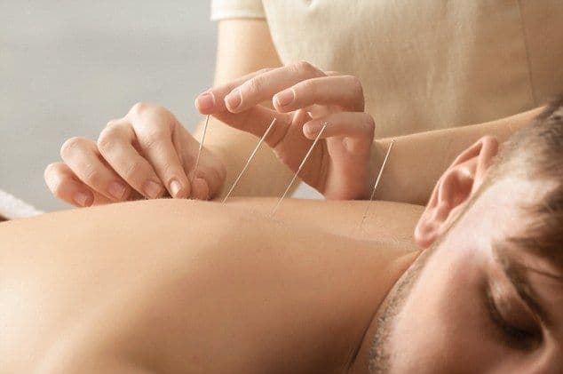 Manfaat Akupuntur bagi Penderita Stroke, Terapi Pendukung yang Bantu Percepat Pemulihan