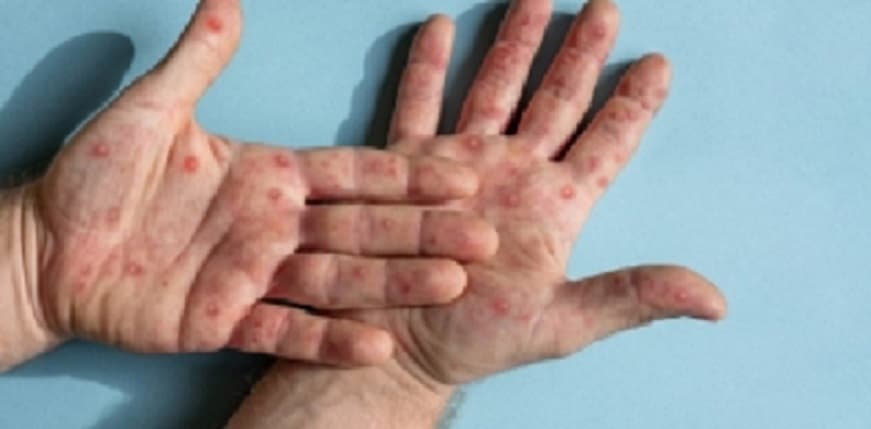 Kenapa Virus Tak Masuk dalam Kategori Makhluk Hidup?