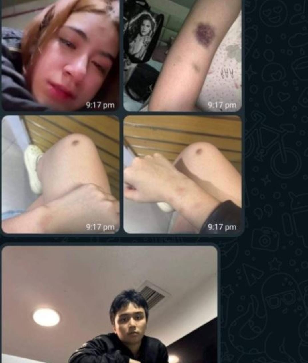 Anak Willy Dozan Aniaya Pacar Hingga Memar Parah, Sebut Enggak Takut Polisi