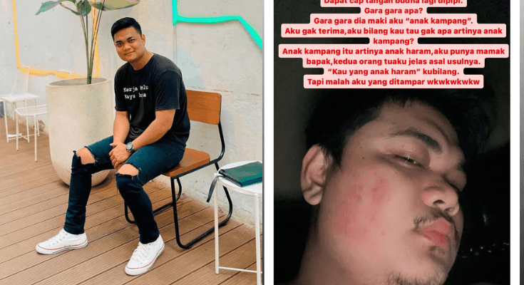 Siapa Itu Ray Faldo? Adik Ragil Mahardika yang Viral Diduga Jadi Korban KDRT Istrinya