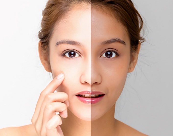 7 Cara Mendapatkan Kulit Sehat Tanpa Skincare Mahal