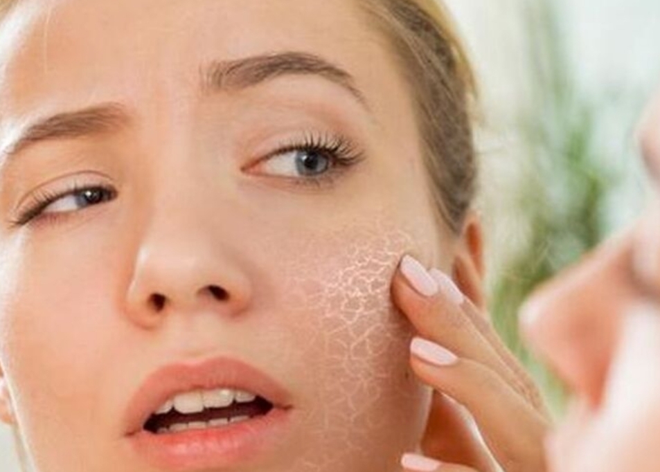 Bebas Kusam! Ini Cara Menjaga Kulit Tetap Cerah & Terhidrasi Sepanjang Hari