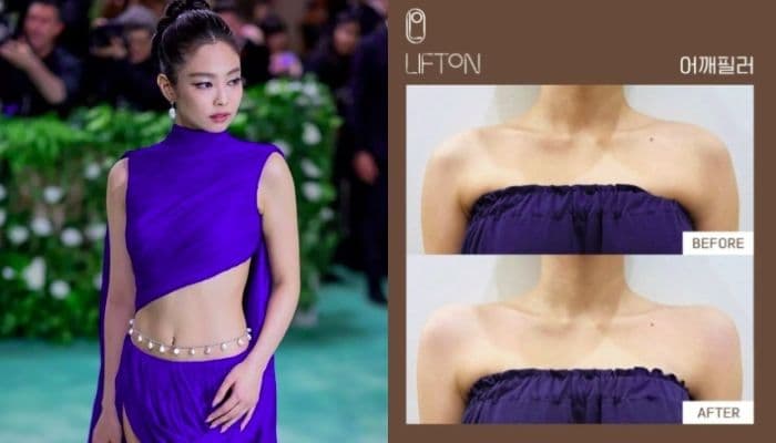 Filler Bahu 90 Derajat Viral di Korea Selatan, Ini Tren Kecantikan Baru ala Jennie BLACKPINK