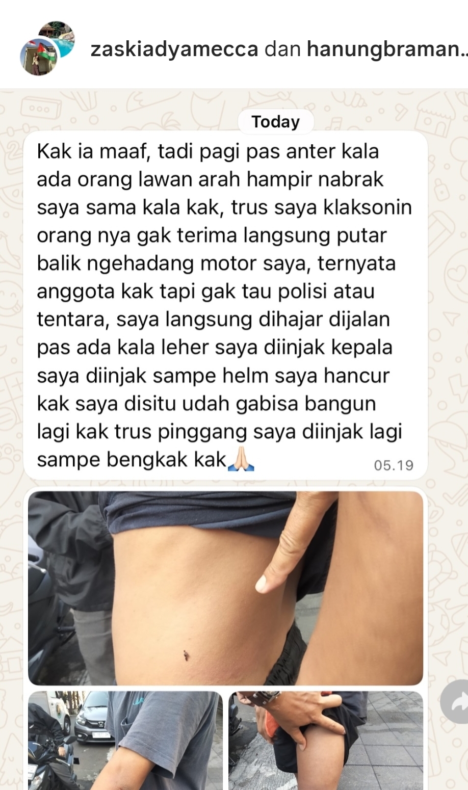 Maafkan Pelaku Pengeroyokan, Zaskia Adya Mecca Tetap Ingin Proses Hukum Berjalan