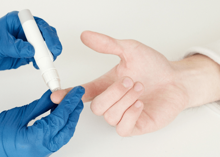 Sering Konsumsi Gula? Ini Dampaknya bagi Kesehatan Gigi dan Gusi