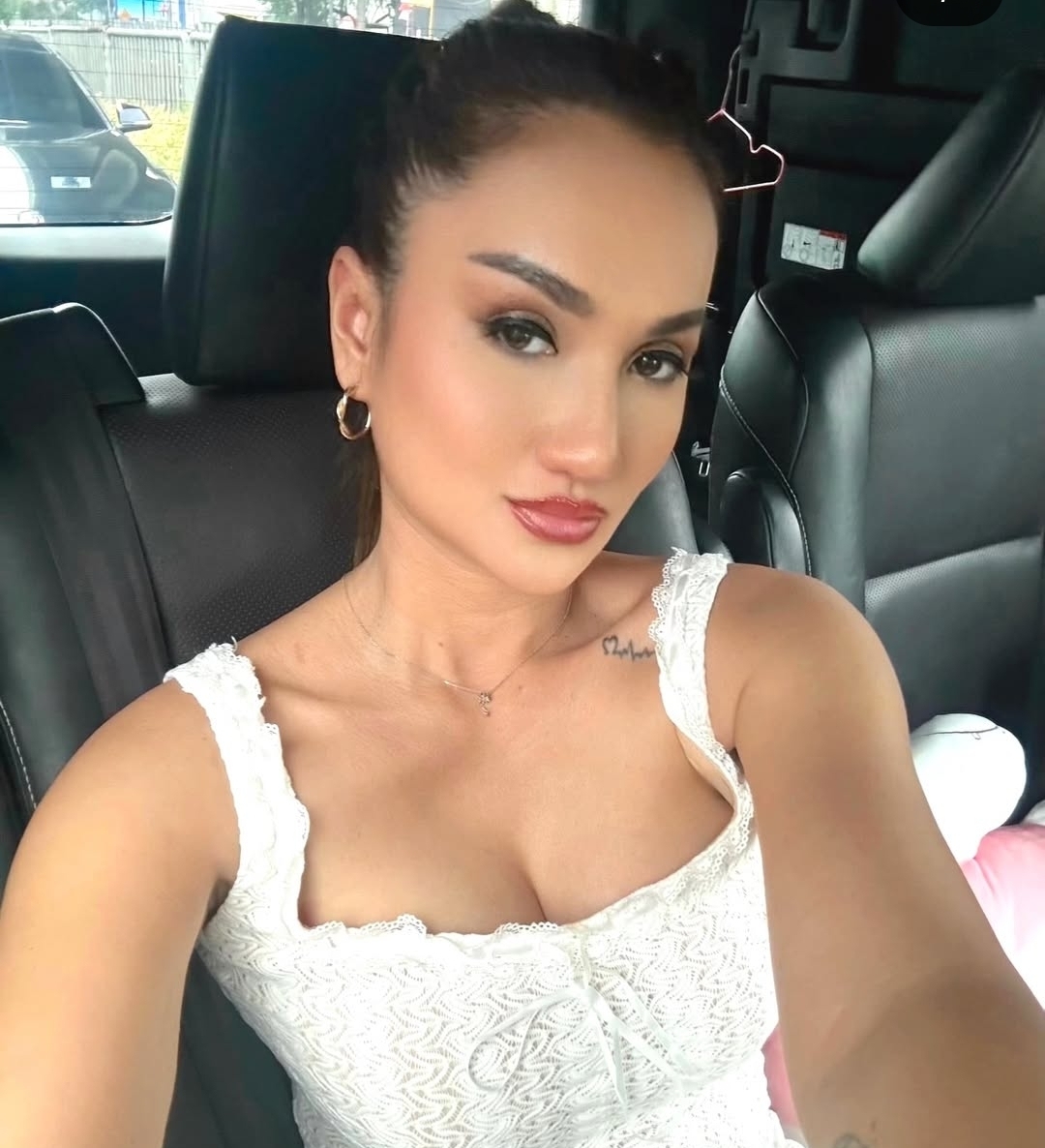 Tengku Dewi Putri Balas Haters Usai Pamer Pasca Operasi Plastik: Silakan Unfollow